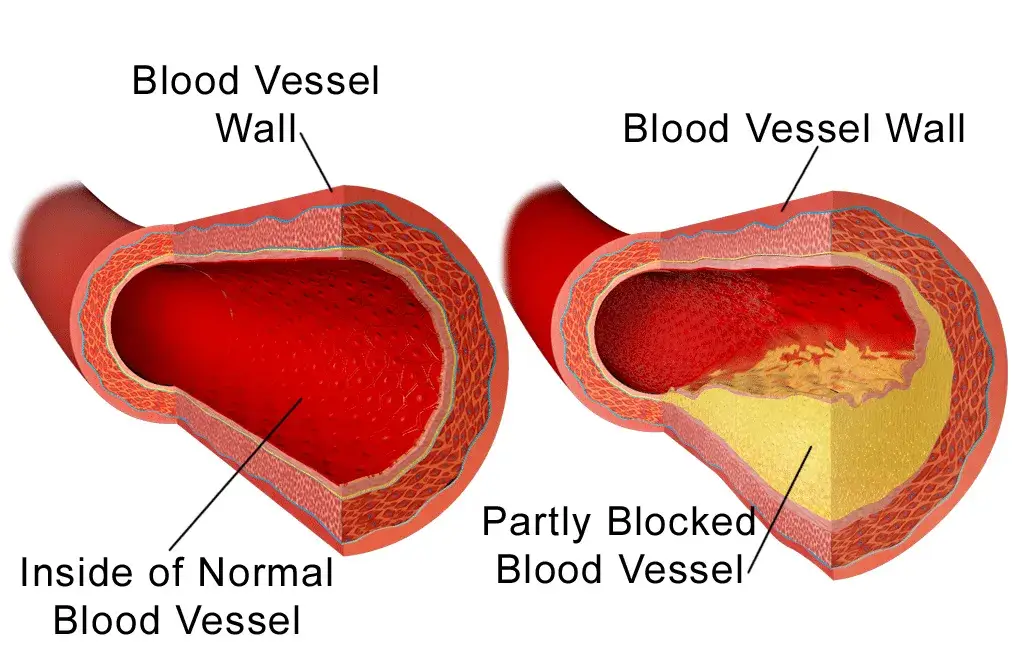 Cholesterol